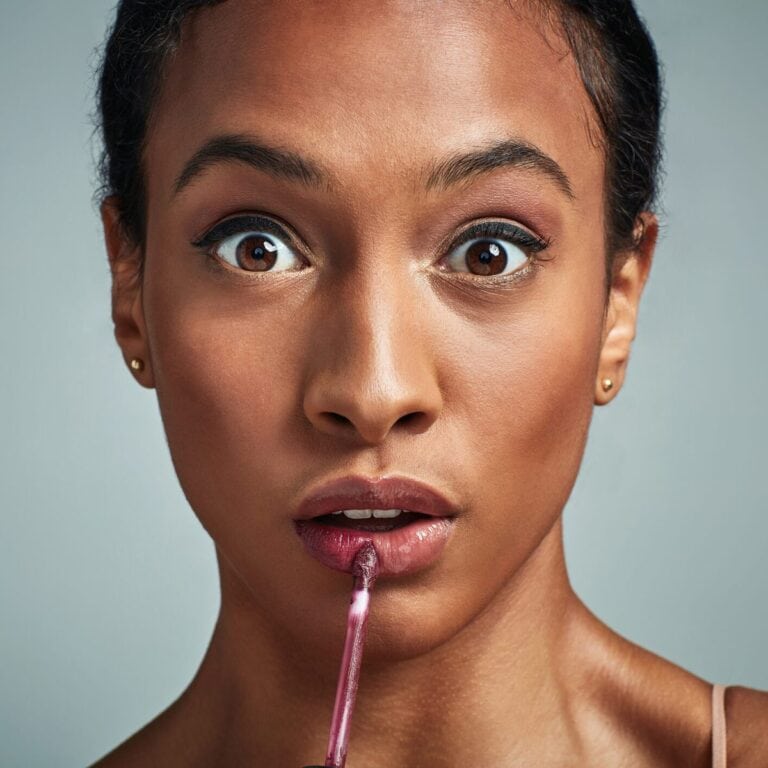 Lip Filler Migration