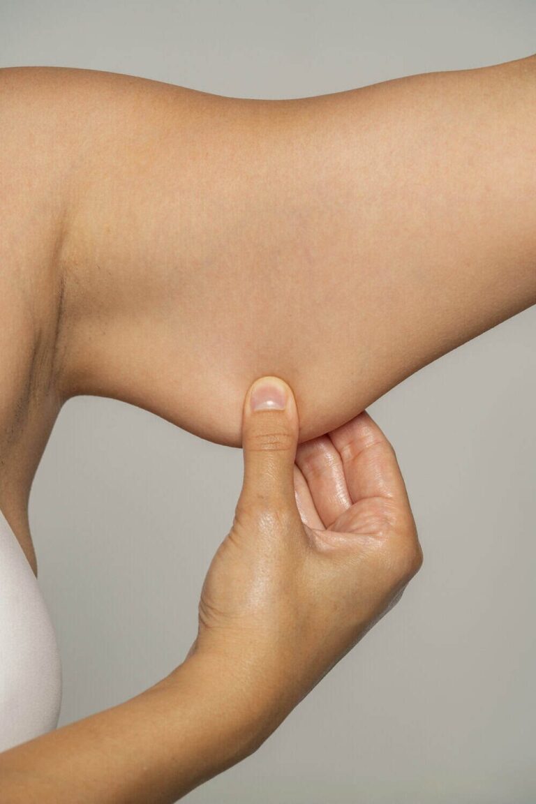Upper Arm Laxity