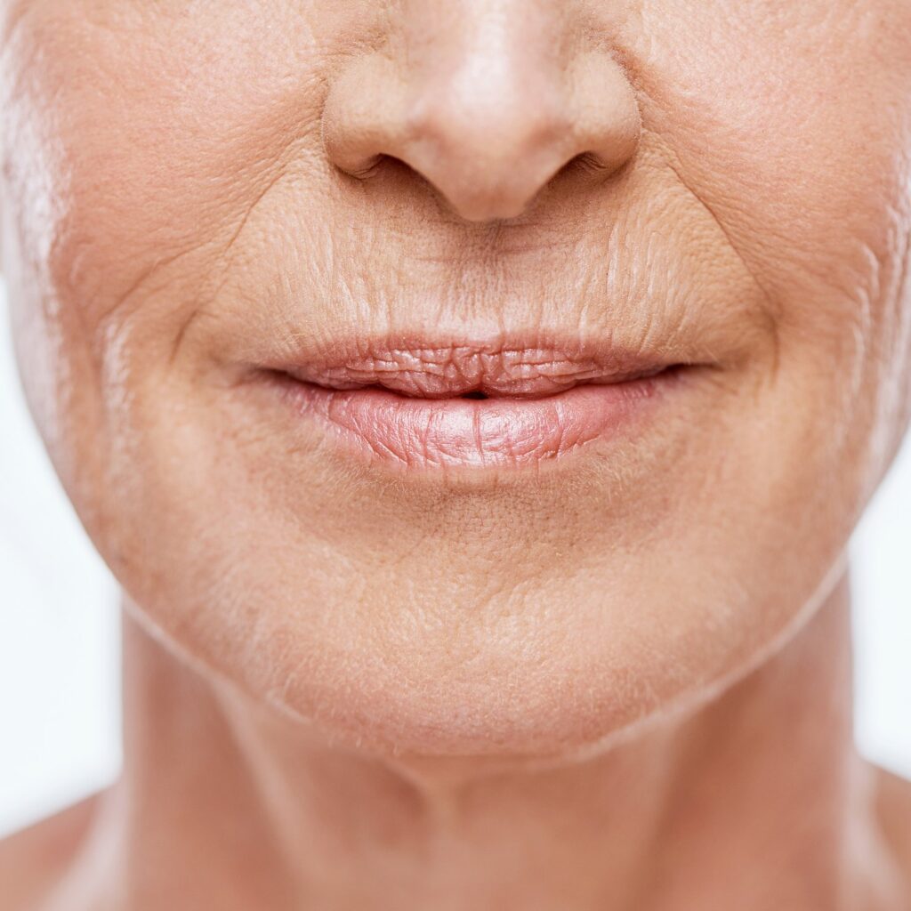 Horizontal neck lines