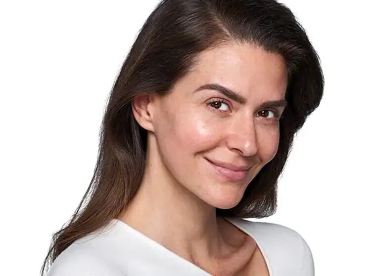 The same mid face after SkinVive, the surface smoother and more hydrated looking