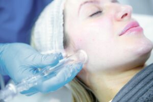HydraFacial handpiece passed over the cheek during treatment